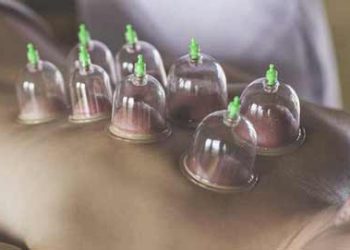 آشنایی با بادکش درمانی و مزایای آن