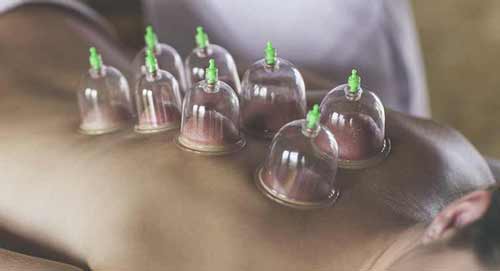 آشنایی با بادکش درمانی و مزایای آن