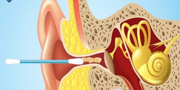 بهترین روش از بین بردن جرم گوش چیه؟