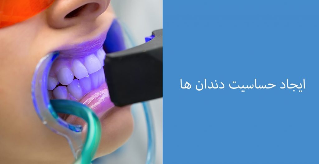 تیر کشیدن دندان بعد از بلیچینگ