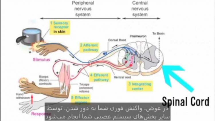 آیا بدون مغز می‌توان زندگی کرد؟