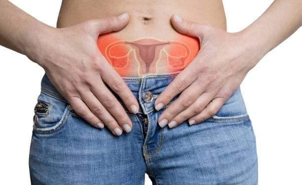 اگر یکی از این سه علامت را دارید، مبتلا به سندرم تخمدان پلی کیستیک هستید.