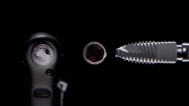 استحکام و مقاومت ایمپلنت دندان