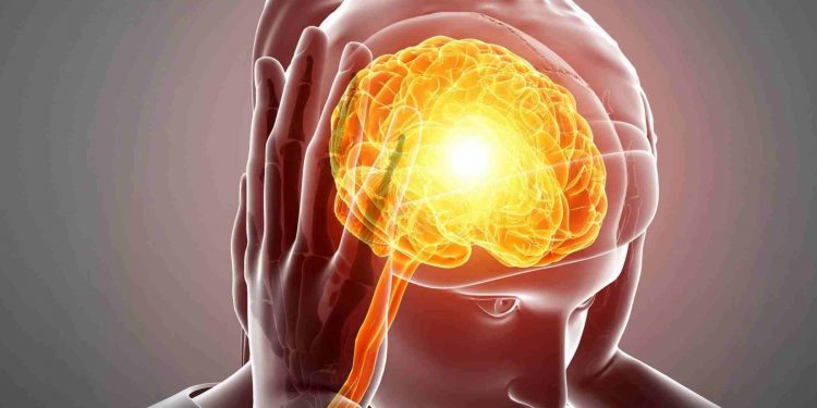متخصص مغز و اعصاب