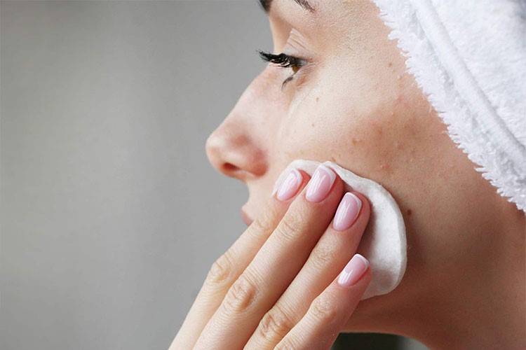 جوش سرسیاه، نکات درمانی و پیشگیری