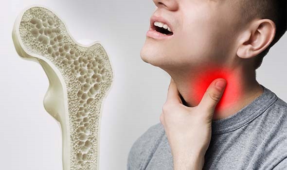 بین پوکی استخوان و پرکاری تیروئید چه رابطه ای وجود دارد؟