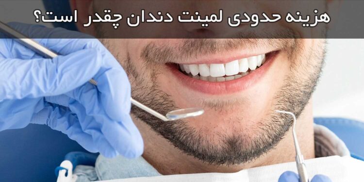 هزینه حدودی لمینت دندان چقدر است؟