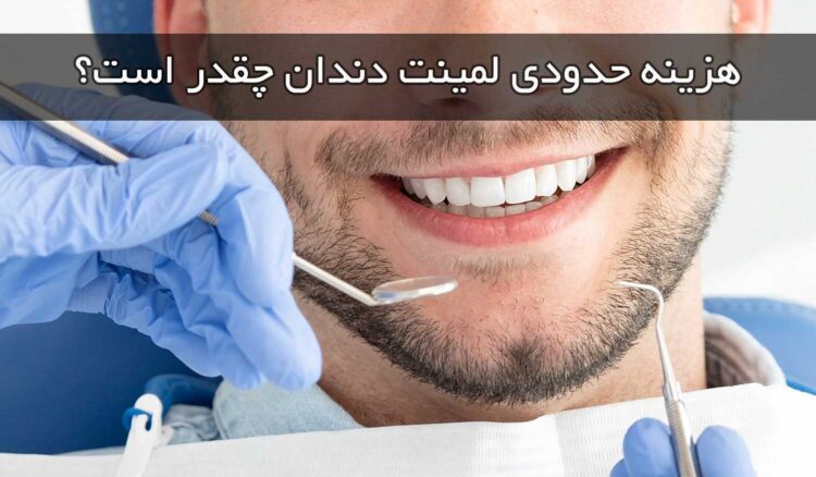 هزینه حدودی لمینت دندان چقدر است؟