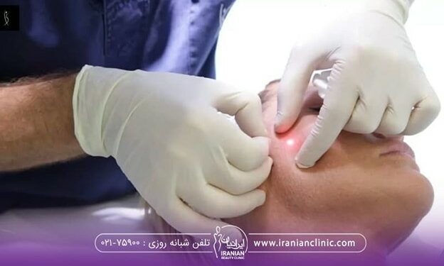 فردی که خوابیده و درکتر با لباس سرمه ای و دستکش سفید در حال انجام اندولیفت صورت می باشد