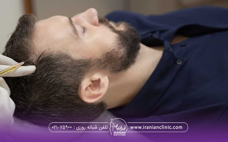 مردی که خوابیده است و چشم هایش بسته است دستان دکتری که دستکش سفید دارد و یک دست روی سر فرد و بایک دست در حال تزریق پی ار پی میباشد-پی آر پی مو