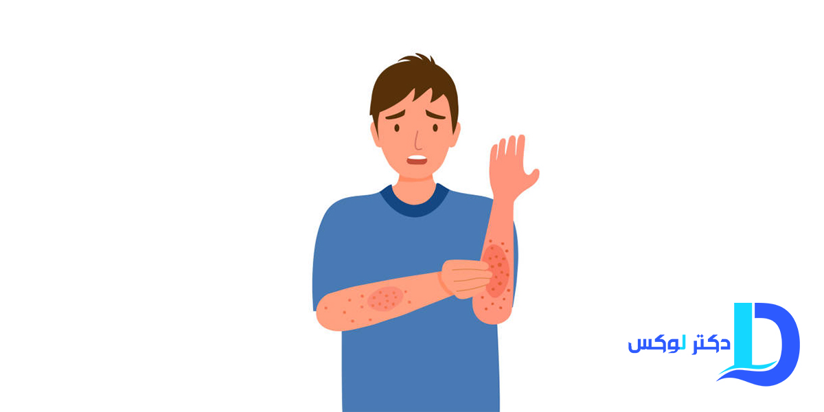 کپسول ال لیزین یوروویتال