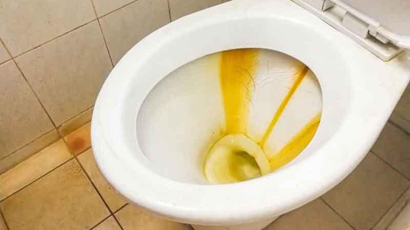از بین بردن زردی کاسه توالت به روش طبیعی با کمک شستشوی مرتب